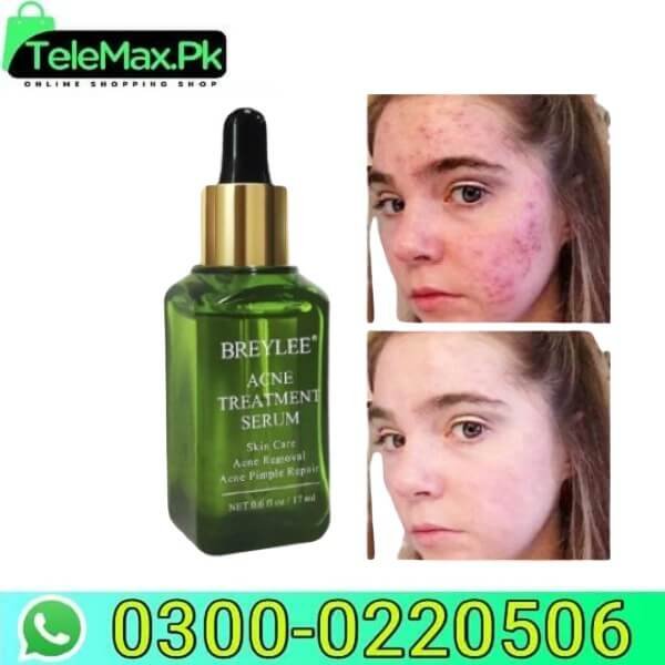 Breylee Acne Treatment Serum in Pakistan